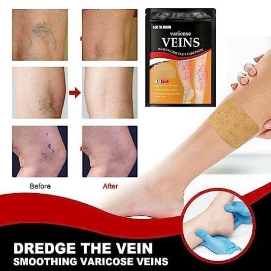 Varicose Veins Patches 12 pcs