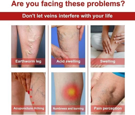 Varicose Veins Patches 12 pcs