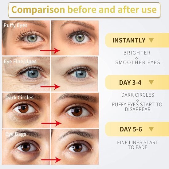 24K Gold Under Eye Patches