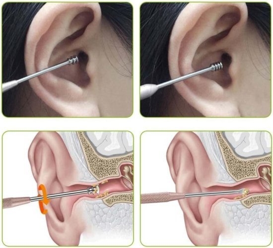 6 in 1 Ear Wax Cleaner set