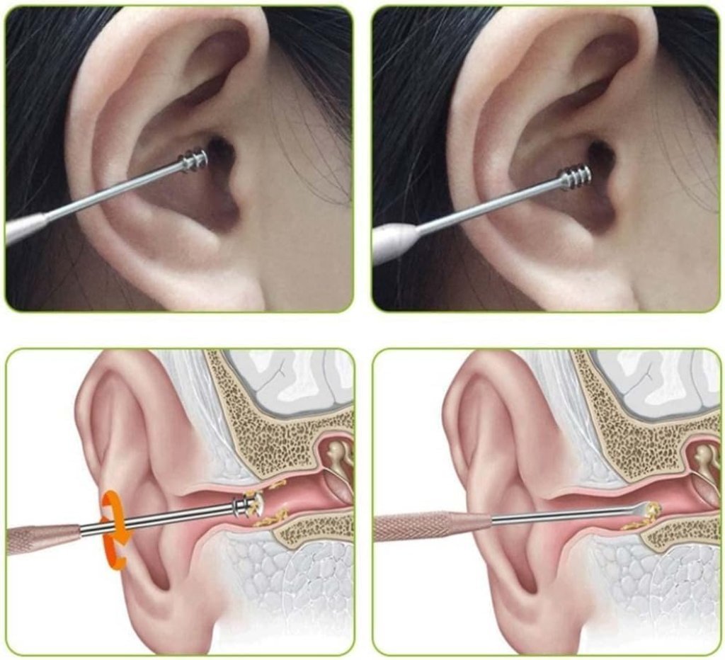 6 in 1 Ear Wax Cleaner set