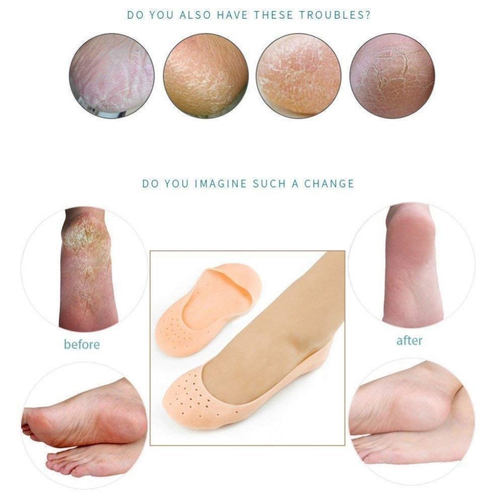 Silicon Socks Anti Crack Full Heel