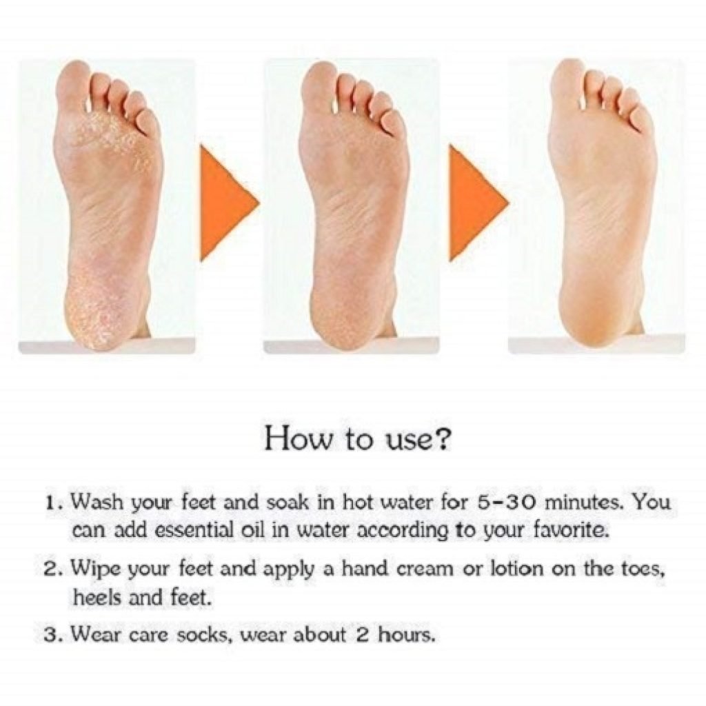 Silicon Socks Anti Crack Full Heel