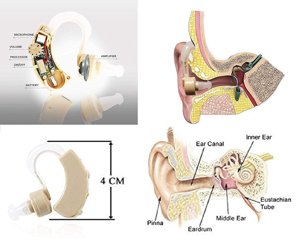 Cyber Sonic Hearing Machine