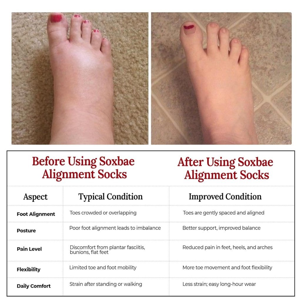 Foot Alignment Socks