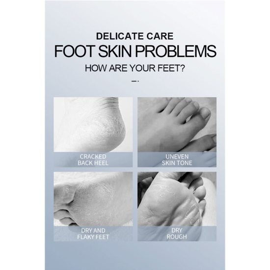 Foot Peeling Mask Dead Skin remover