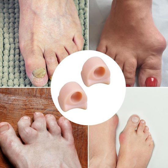 Silicone Gel Toe Separator Ring 1 Pair