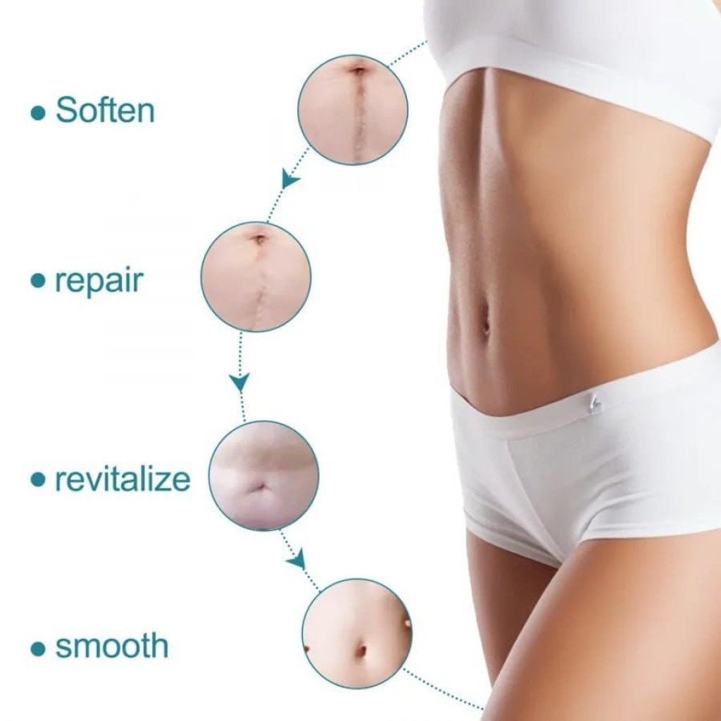 Silicone Scar Removal Sheet